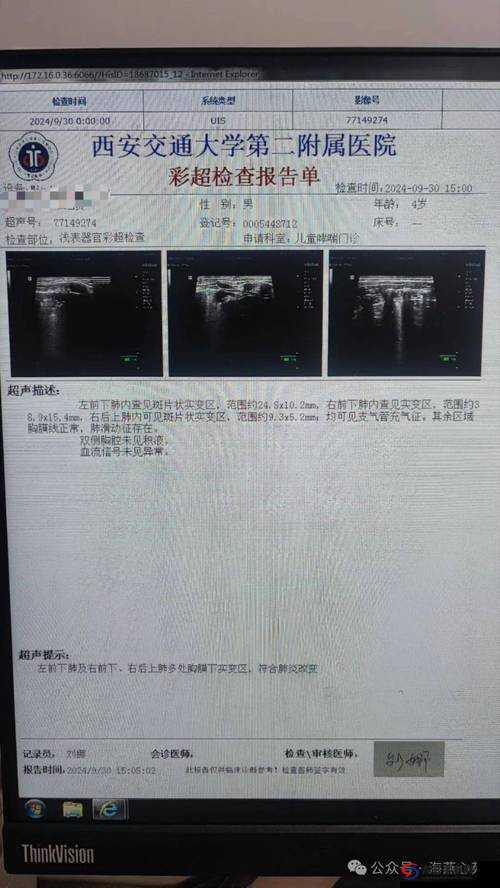 B超检查全解析：常见用途、检查项目及注意事项，了解B超在医疗诊断中的重要作用