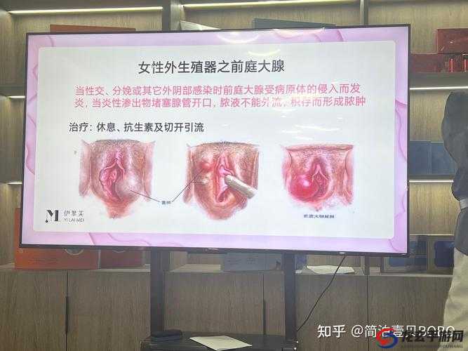 同房后女生下面痒是怎么回事？该如何应对？原因大揭秘