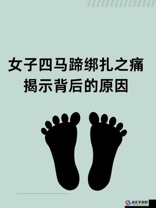 为什么有人被扎带绑住手脚？这背后隐藏着怎样的秘密？